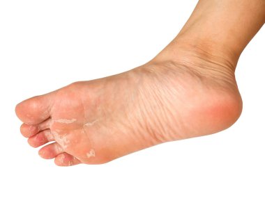 Kabuk soyma beyaz arka planda izole edilmiş, kırpma yolu ile. Sağlık hizmetleri kavramı.