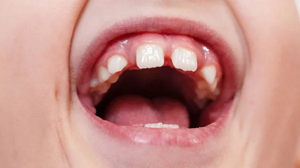 gaps between teeth. rarely growing teeth. wide open mouth. the c