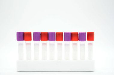 Beyaz arka plan üzerinde hastadan kan tüpü örnek. alan, alan için metin ve görüntü kopyalama. Tıbbi donatımı .