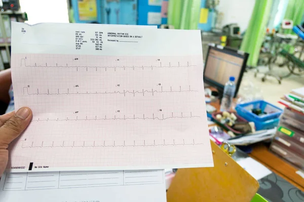 心臓解析 心電図 Ecg グラフ手医師が病院で — ストック写真