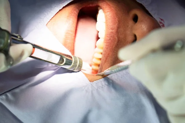 Anesthesia for tooth extraction by the dentist. Dentistry in hospital.