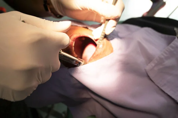 Anestesia Para Extracción Dental Por Dentista Odontología Hospital — Foto de Stock