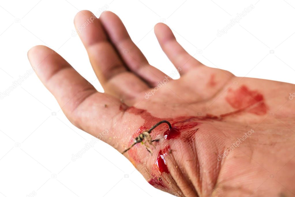 The wound was caught fishing at hand isolated on white background of file with Clipping Path .