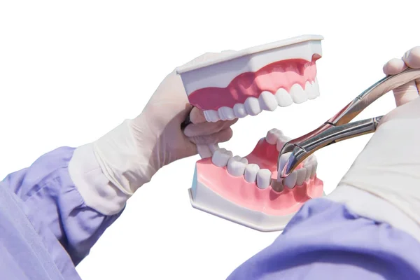 Model Gigi Digunakan Untuk Menunjukkan Ekstraksi Gigi Oleh Dokter Terisolasi — Stok Foto