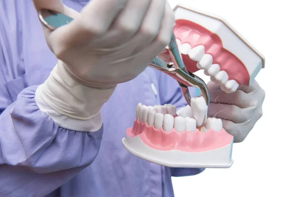 Modelo Dental Utiliza Para Demostración Extracción Dientes Por Los Médicos — Foto de Stock