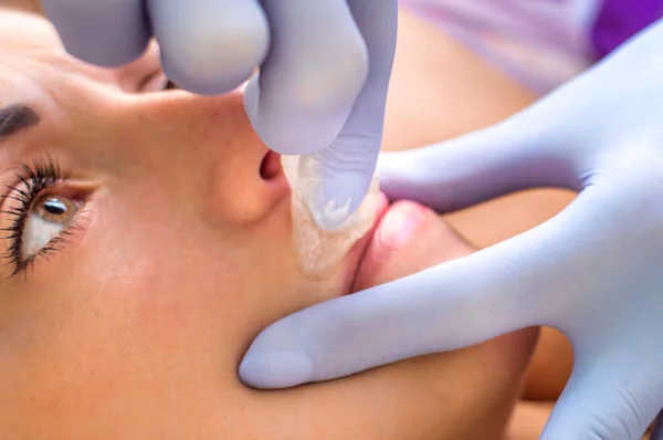 Procedure Removing Hair Woman Lip Close Beauty Salon — Stock Photo, Image