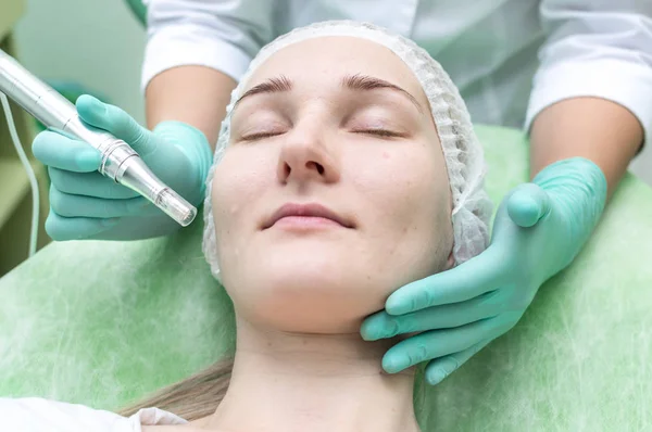 Beautician makes mezopilling young girl in the beauty salon close-up mezo scooter. Without processing. Real skin.