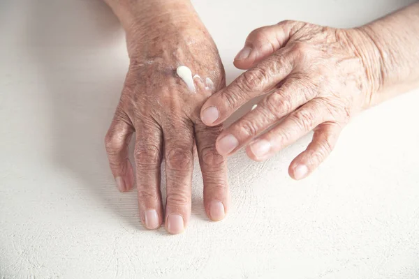 Elderly woman applies the cream on the hand. — Stock Photo, Image