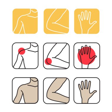 omuz dirsek el bakım ağrı tedavisi uzmanı