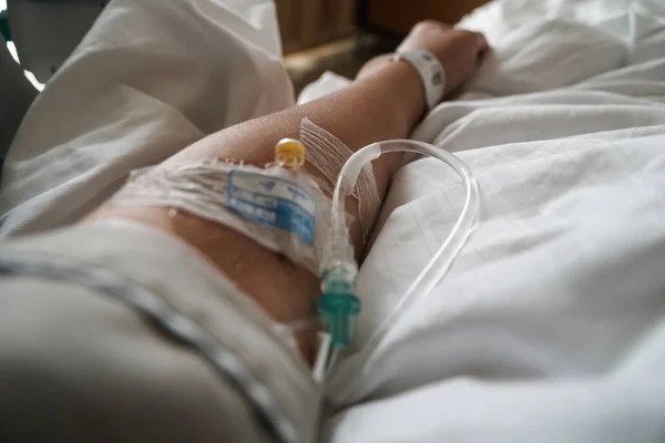Arm Van Patiënt Met Buis Ziekenhuis — Stockfoto