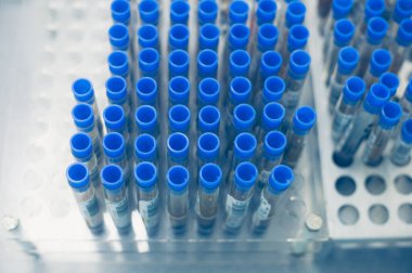 Laboratuvarda biyomateryalli test tüpleri. Laboratuvarda tıbbi, kimyasal veya bilimsel laboratuvar araştırma ve yenilik kavramı.