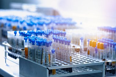 Laboratuvarda biyomateryalli test tüpleri. Laboratuvarda tıbbi, kimyasal veya bilimsel laboratuvar araştırma ve yenilik kavramı.