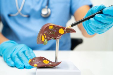 Dünya Hepatit Günü 'nde siroz, karaciğer kanseri, yağlı karaciğer, karaciğer anatomisi olan Asyalı doktor..