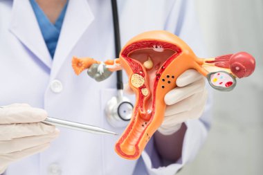 Rahim, hastanede teşhis ve tedavi için insan anatomisi modeli tutan doktor..