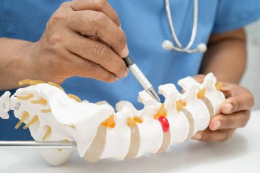 Omurga ve kemik modeli taşıyan Asyalı doktor, ortopedi bölümünde tedavi için bel kemiği yerinden oynamış disk parçası..