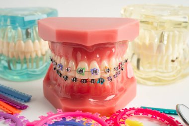 Ortodontik bağlar halkalar ve kravatlar, diş hekimliği üzerine çalışan dişçi için model..