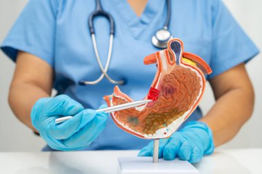 Mide hastalığı, hastanede teşhis ve tedavi için anatomi modeli tutan bir doktor..