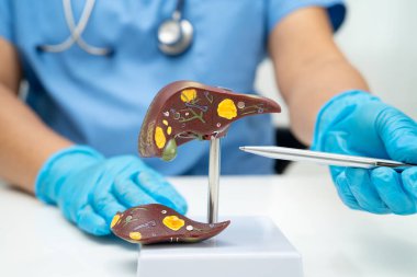 Dünya Hepatit Günü 'nde siroz, karaciğer kanseri, yağlı karaciğer, karaciğer anatomisi olan Asyalı doktor..
