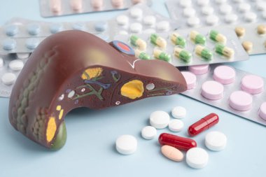 Hap tedavisi gören karaciğer modeli, siroz, karaciğer kanseri, yağlı karaciğer..
