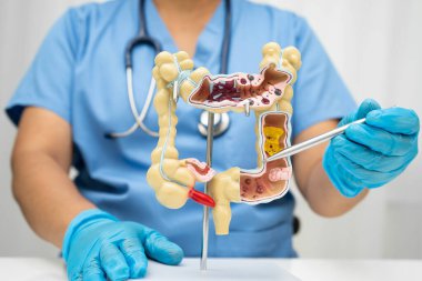 Bağırsak, Asyalı kadın insan anatomisi modeli tutuyor..