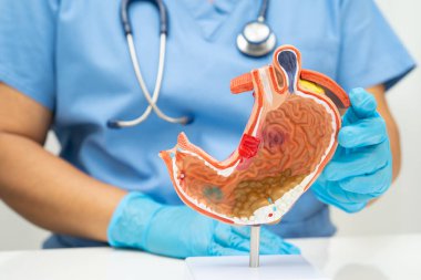Mide hastalığı, hastanede teşhis ve tedavi için anatomi modeli tutan bir doktor..