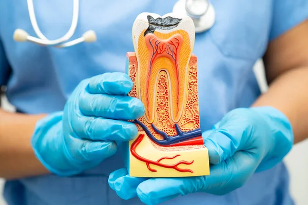 Diş implantı tutan diş hekimi, çeneye yapay diş kökleri, diş tedavisi kanal tedavisi, diş eti hastalığı, dişçi için diş modeli.