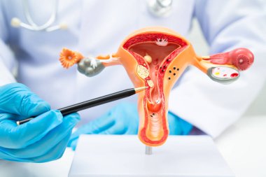 Rahim, hastanede teşhis ve tedavi için insan anatomisi modeli tutan doktor..