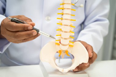 Omurga ve kemik modeli taşıyan Asyalı doktor, ortopedi bölümünde tedavi için bel kemiği yerinden oynamış disk parçası..