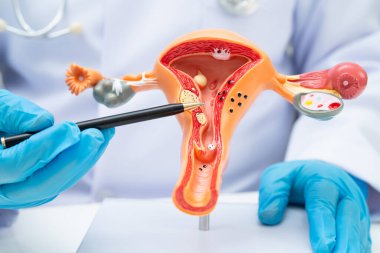 Rahim, hastanede teşhis ve tedavi için insan anatomisi modeli tutan doktor..