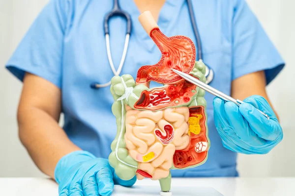 Midesi ve bağırsağı olan sindirim sistemi, Asyalı doktor hastanede teşhis ve tedavi için insan anatomisi modeli tutuyor..