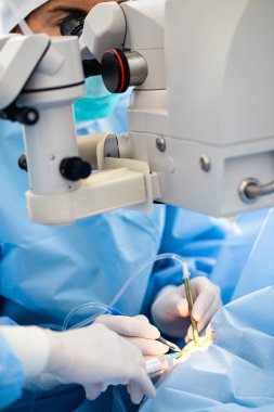 Göz cerrahi işlem, katarakt ve diyoptri düzeltme tedavisinde. Cerrahi uygulama Çoklu odak lens implantları. Tıbbi sağlık ve teknoloji Tema.