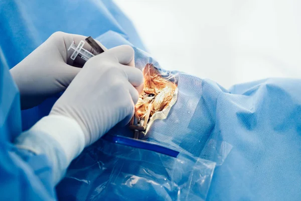 Augenchirurgie Behandlung Von Katarakt Und Dioptrienkorrektur Chirurgische Implementierung Multifokaler Linsenimplantate — Stockfoto