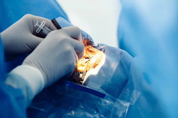 Augenchirurgie Behandlung Von Katarakt Und Dioptrienkorrektur Chirurgische Implementierung Multifokaler Linsenimplantate — Stockfoto