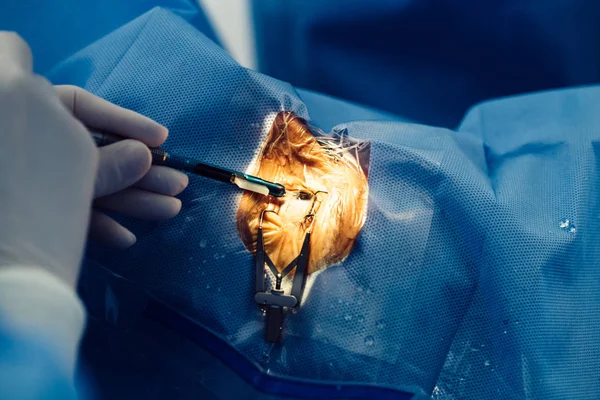 Processo Cirurgia Ocular Tratamento Catarata Correção Diopter Implementação Cirúrgica Implantes — Fotografia de Stock