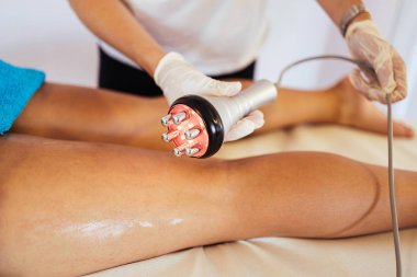 Cavitation RF vücut tedavisi ve sağlık güzelliğinin iyileştirilmesi ve yağ ve selülit alınması için çağdaş ilaç