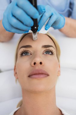 Microneedle mesotherapy. Beautiful blond woman receiving microneedling rejuvenation treatment.  clipart