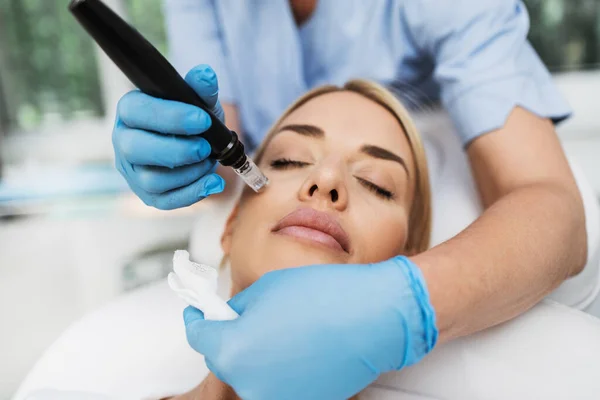 Microneedle Mesotherapie Mooie Blonde Vrouw Die Microneedling Verjonging Behandeling Krijgt — Stockfoto