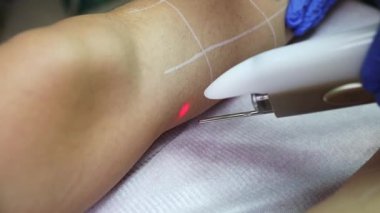 Profesyonel güzellik uzmanı, güzellik salonunda kadın bacağı üzerinde lazer tüyü çıkarma prosedürü uyguluyor. Etkili ve acısız vücut kıllarını almak için modern ekipmanlar kullanıyor.