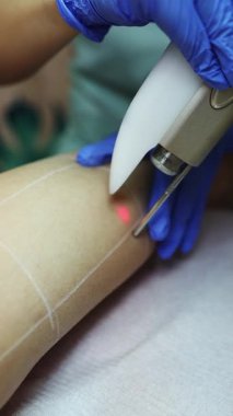 Profesyonel güzellik uzmanı, güzellik salonunda kadın bacağı üzerinde lazer tüyü çıkarma prosedürü uyguluyor. Etkili ve acısız vücut kıllarını almak için modern ekipmanlar kullanıyor.