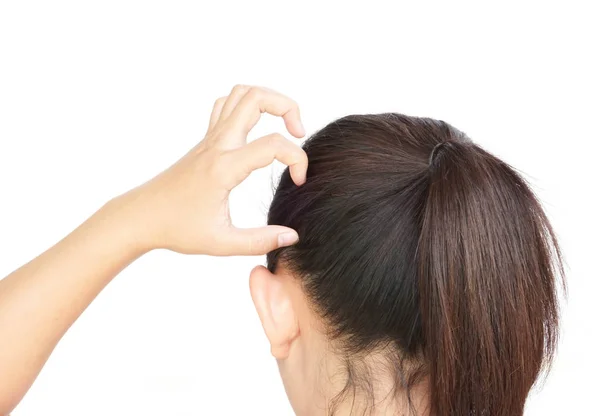 クローズ アップ女性手かゆみ頭皮 髪のケアの概念 — ストック写真