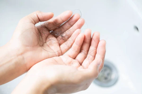 Woman Holding Hair Loss Hand Health Care Shampoo Beauty Product — Stock Photo, Image