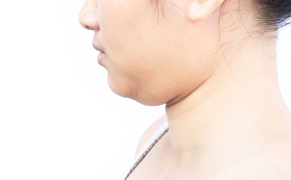Closeup Woman Fat Second Chin Health Care Beauty Concept — Stock Photo, Image