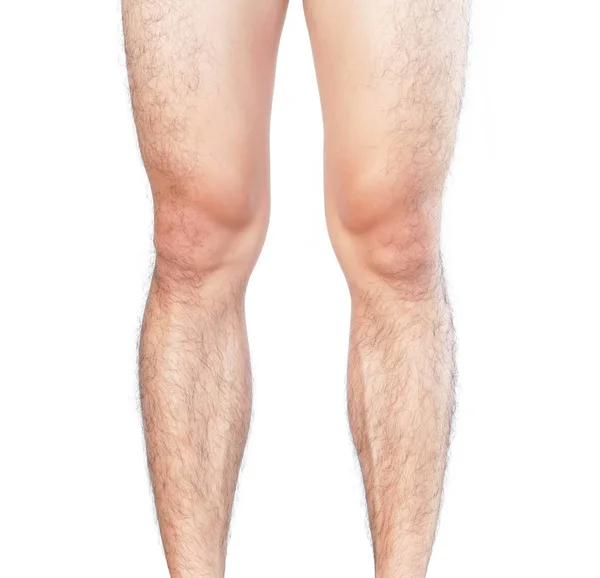 Pernas fechadas homens pele e peludo para o conceito de cuidados de saúde — Fotografia de Stock