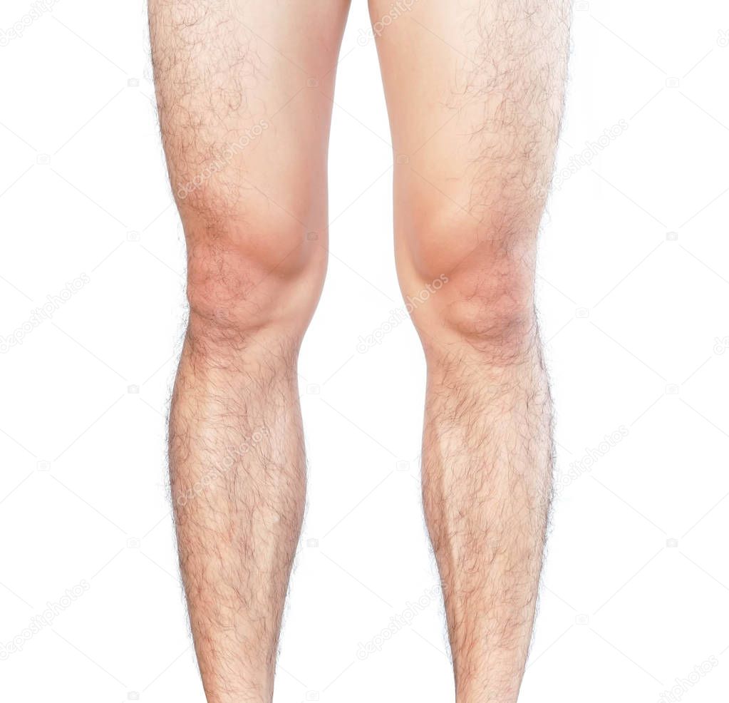 Closeup legs men skin and hairy for health care concept