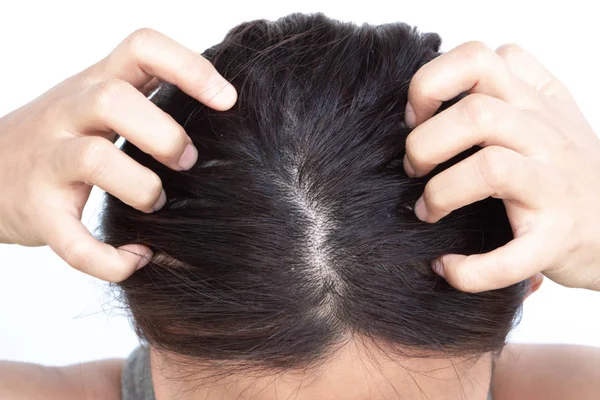 Closeup mulher mão coceira couro cabeludo, conceito de cuidados com o cabelo — Fotografia de Stock