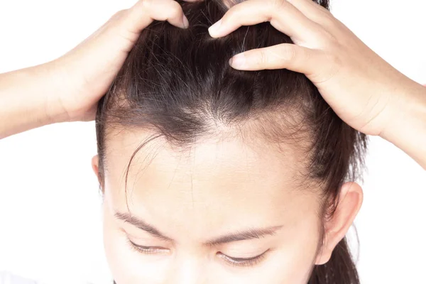 Mulher grave problema de perda de cabelo para cuidados de saúde shampoo e conceito de produto de beleza, foco seletivo — Fotografia de Stock