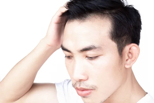 Young man serious hair loss problem for health care medical and shampoo product concept — Stock Photo, Image