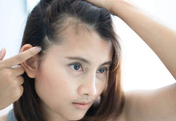 Mulher olhando reflexão no espelho grave problema de perda de cabelo para shampoo cuidados de saúde e conceito de produto de beleza — Fotografia de Stock