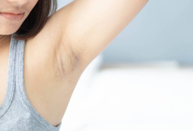 Kadın sorunu siyah koltuk altı cilt bakımı ve güzellik kavramı, seçici odak için beyaz yatak arka planda yatıyor