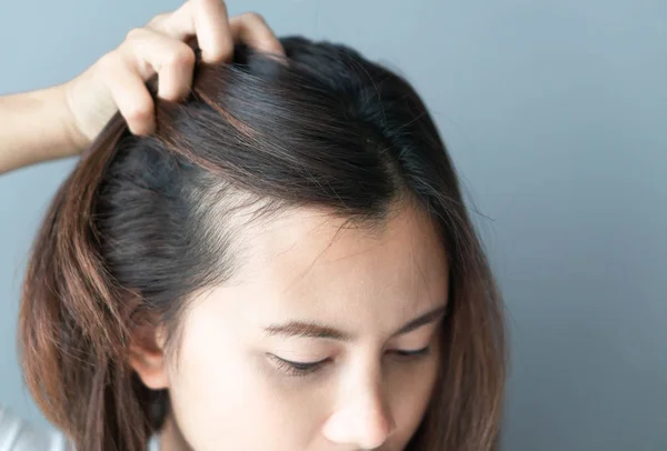 Жінка дивиться відображення в дзеркалі серйозна проблема випадіння волосся для охорони здоров'я шампунь і концепція косметичного продукту — стокове фото